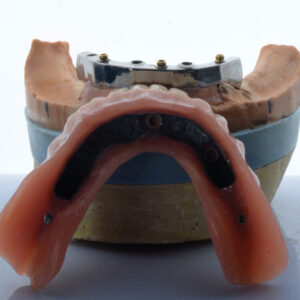 Rhein’ 83 Attachments