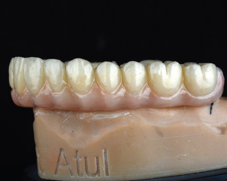 PMMA Milled - Image 3