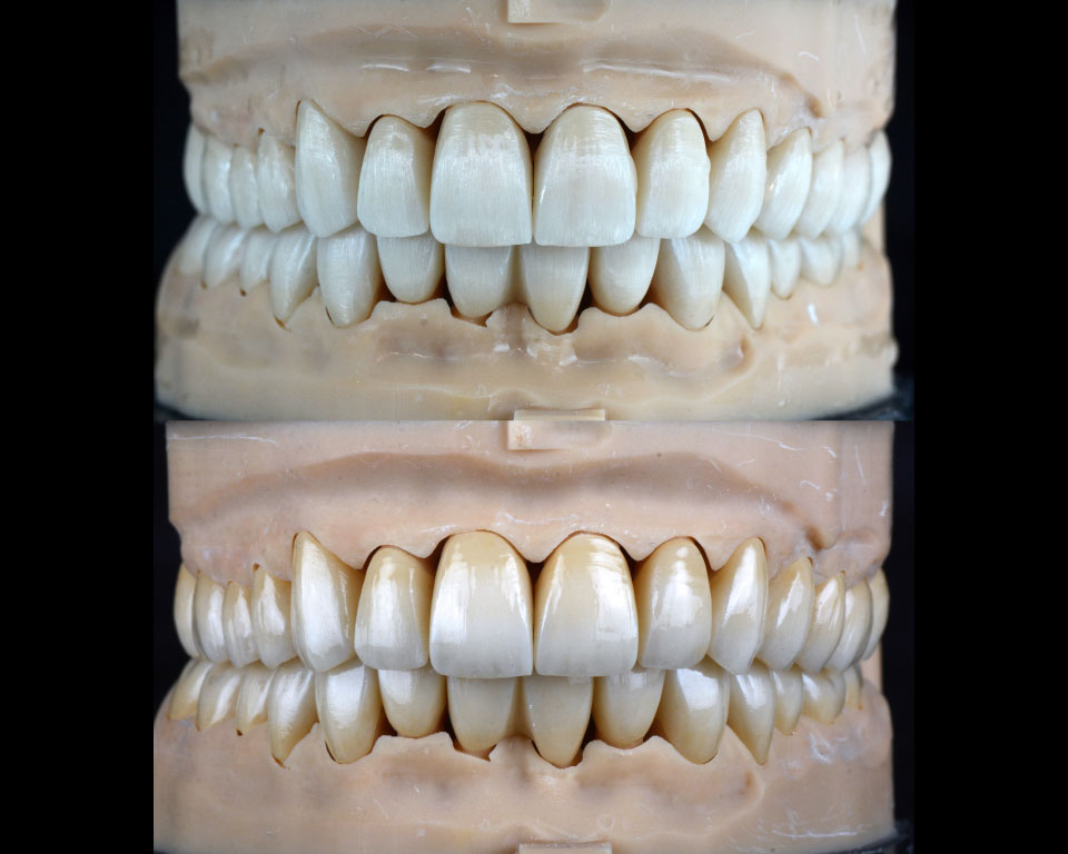 Zirconia - Image 4