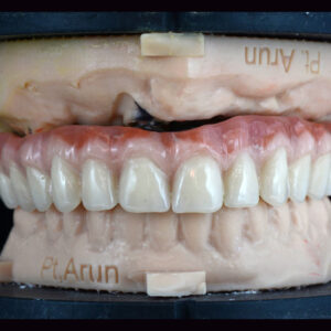 Titanium wrapped Acrylic