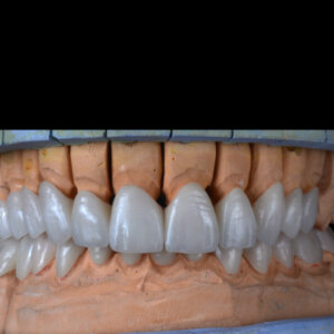 ZirCAD Prime & ZirCAD Esthetic